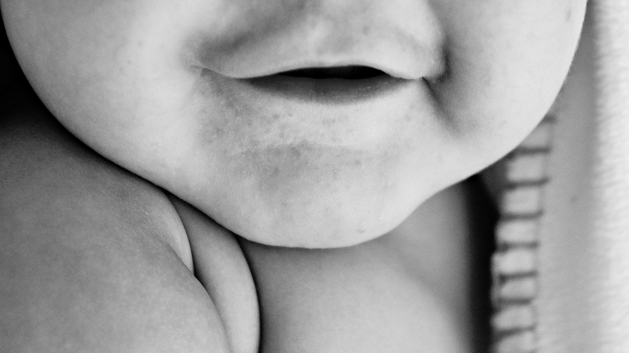 酒渣鼻新进展，治疗与研究的新突破与成果展示